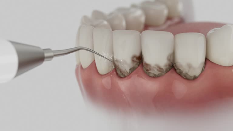 Trusted Invisalign Clear Aligners service in Lincoln, ID - Dentist Open Now